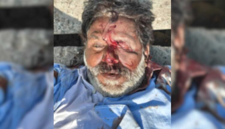 Unidentified man found dead near railway tracks in Secunderabad